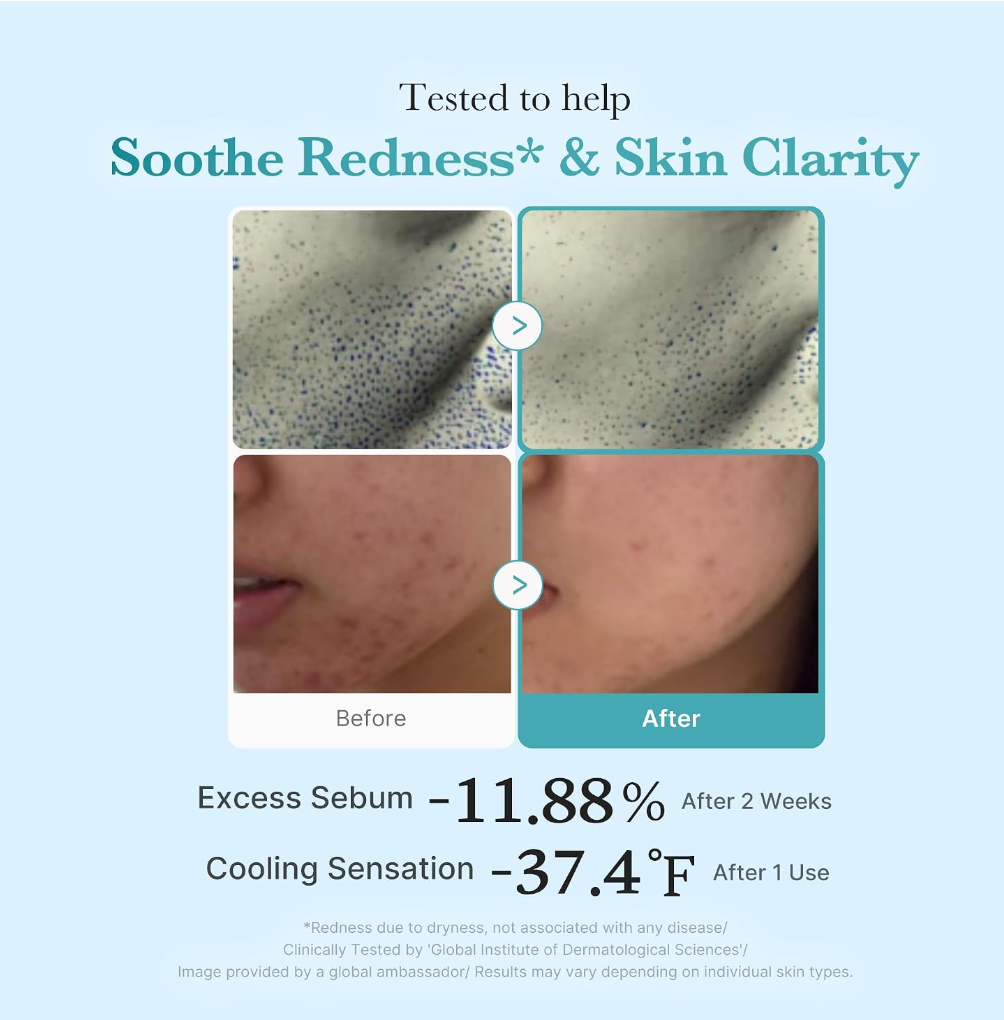 An informational marketing graphic for a skincare product. The top text reads 'Tested to help Soothe Redness* & Skin Clarity', Medicube Azelaic Acid Niacinamide Clarifying Toner 250ml
