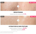 Before and after skin improvement results with brightening and hydration effects, April Skin TXA Niacinamide 99 Milky Toner 150ml