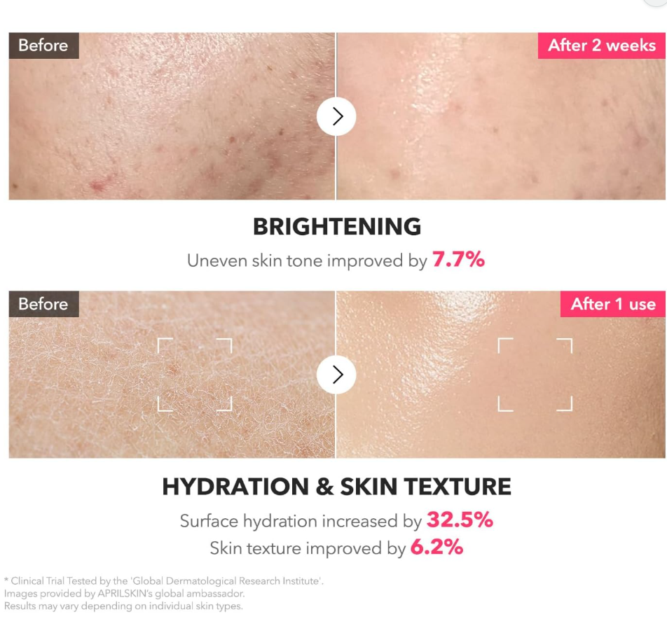 Before and after skin improvement results with brightening and hydration effects, April Skin TXA Niacinamide 99 Milky Toner 150ml