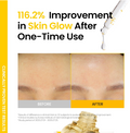 Advertisement showing before and after effects of a skincare product with text about skin glow improvement, ONGREDIENTS Skin Barrier Glow Serum 50ml