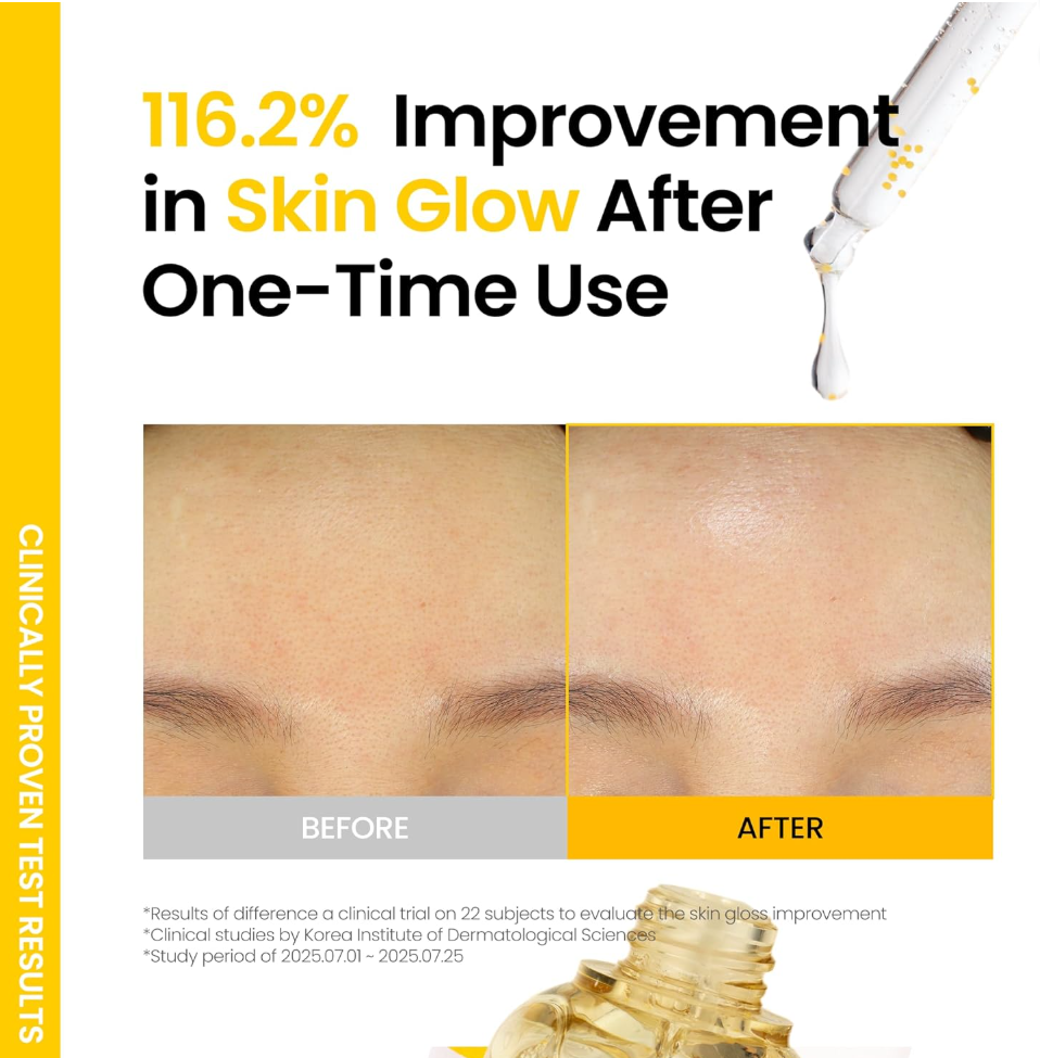 Advertisement showing before and after effects of a skincare product with text about skin glow improvement, ONGREDIENTS Skin Barrier Glow Serum 50ml