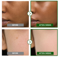 Before and after comparison of skin treatment on a person's face, showing visible improvement after 4 weeks, Goodal Vita-C Dark Spot Care Cream 50ml