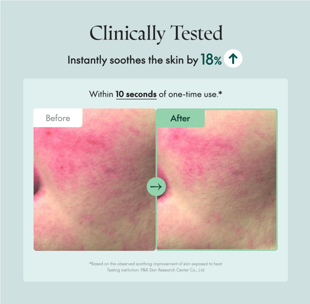 Before and after skin comparison with text indicating clinical testing and skin soothing effects, Purito Wonder Releaf Centella Serum 60ml