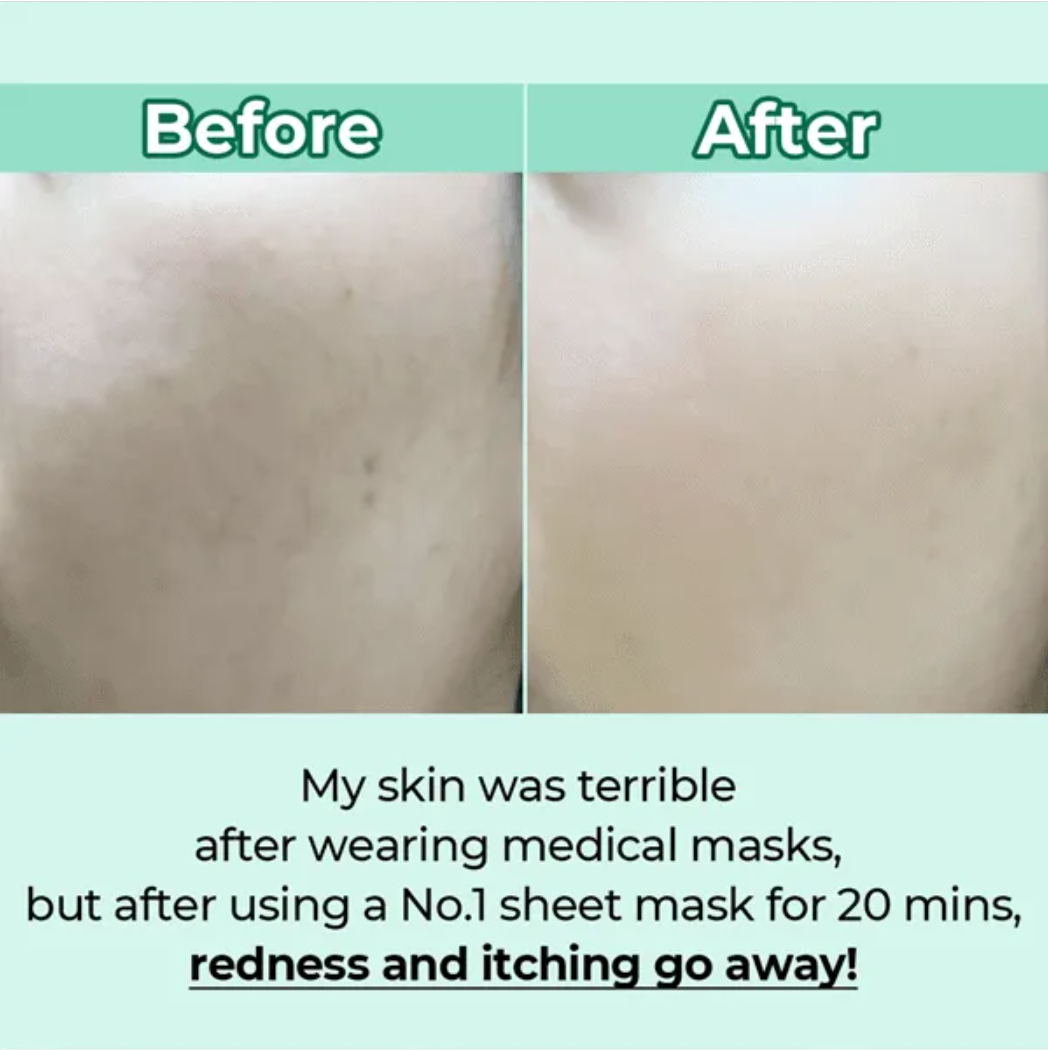 Before and after comparison of skin with text about using a No.1 sheet mask, Numbuzin No.1 Dewy Glow Spa Sheet Mask 1pc