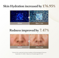 Before and after effects of a skincare product on skin hydration and redness with clinical trial results, Dr. Althea 345 Relief Cream Mask 4pcs