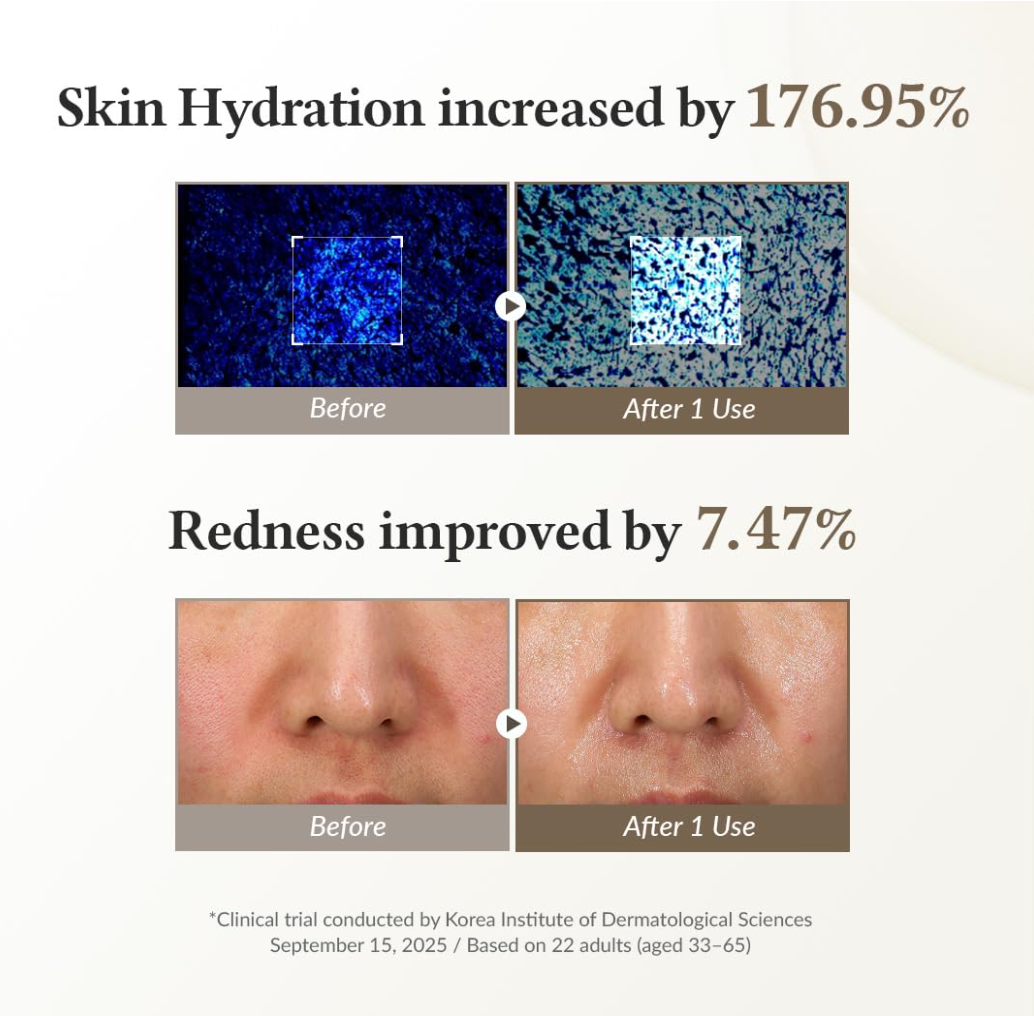 Before and after effects of a skincare product on skin hydration and redness with clinical trial results, Dr. Althea 345 Relief Cream Mask 4pcs