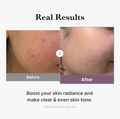 Before and after comparison of skin with blemishes, showing a clear and even skin tone, Medicube Age-R Glutathione Glow Toner 140ml