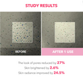Before and after comparison of a surface treatment with study results on skin improvement, April Skin TXA Niacinamide 99 Night Wrapping Mask 80ml