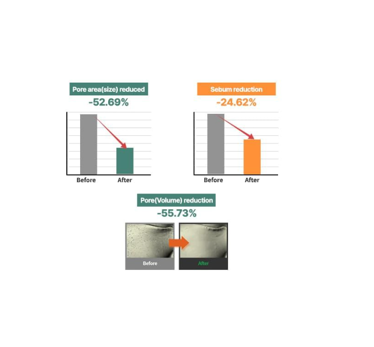 Graphs showing pore area size, sebum reduction, and pore volume reduction with 'Before' and 'After' comparisons, S.nature Aqua Squalane Moisturizing Cream 60ml