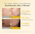 Before and after skin improvement results with percentages on a beige background, Medicube Kojic Acid Turmeric Niacinamide Serum 30ml