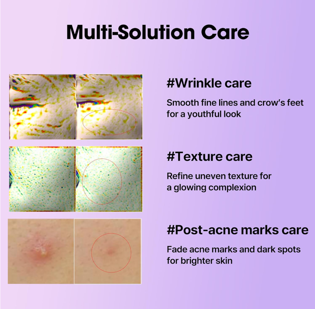 Advertisement for skin care products with images of skin conditions and text describing care solutions on a purple background, Somebymi Retionol Intense Reactivating Serum 30ml