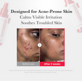 Product advertisement for acne-prone skin with 'Before' and 'After' effects on a person's face, Medicube Hypochlorous Acid Daily Facial Spray 125ml