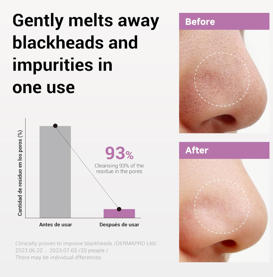 Advertisement showing before and after effects of a blackhead removal product on a nose, Heimish All Clean Balm 120ml