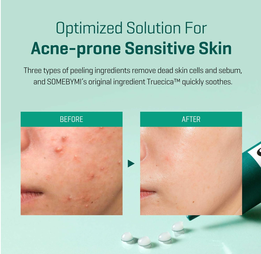 Before and after comparison of acne-prone skin with peeling ingredients and a product container, Somebymi AHA.BHA.PHA 14Days Super Miracle Spot All Kill Cream 30ml