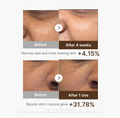Before-and-after skin comparison graphic showing two close-up facial skin panels labeled 'Before' and 'After 4 weeks' plus 'Before' and 'After 1 Use', with text claiming revivification of dull and tired-looking skin and boost of natural glow, Medicube Deep Vita C Capsule Serum 30ml
