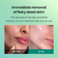 Before and after comparison of flaky dead skin removal with text on a green background, Dr.G Brightening Peeling Gel -120ml