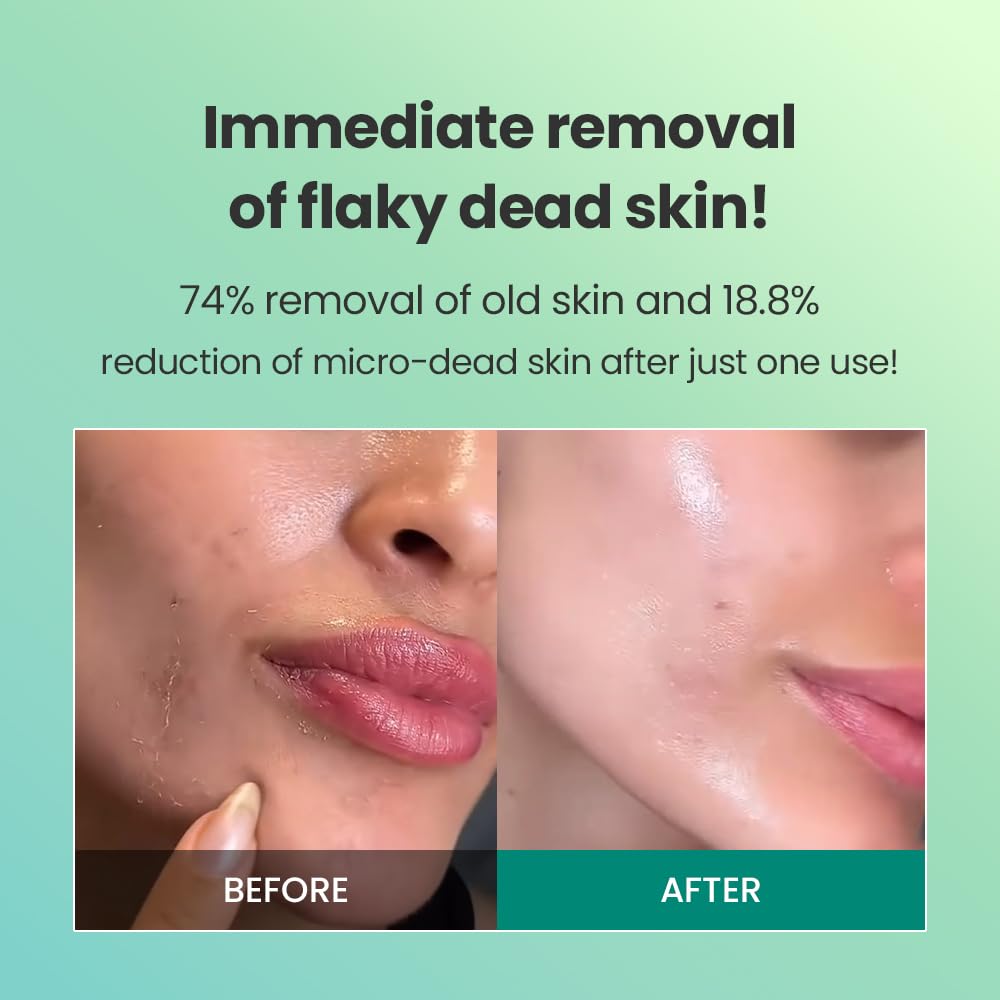 Before and after comparison of flaky dead skin removal with text on a green background, Dr.G Brightening Peeling Gel -120ml
