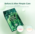 Spot cover patch packaging with green forest design on a light green background, SKIN1004 Tea Trica Spot Cover Patch 22pcs