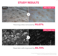 Before and after study results showing pore impurities and dead skin cells removal with a product, April Skin TXA Niacinamide 99 Deep Cleanser 120g