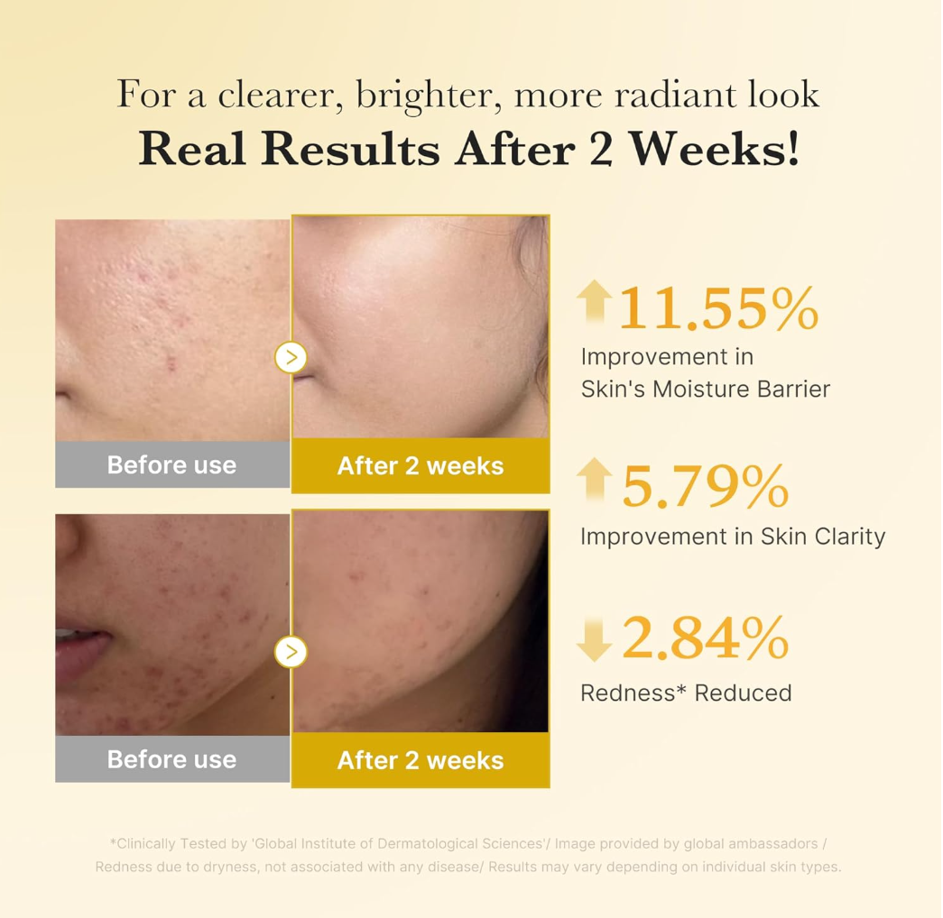 Before and after skin improvement results with percentages on a beige background, Medicube Kojic Acid Turmeric Niacinamide Serum 30ml