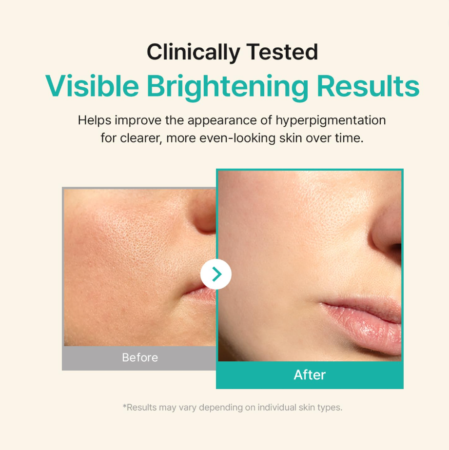 Before and after comparison of skin with visible brightening results on a beige background, Acwell Licorice pH Balancing Advance Serum 30ml
