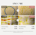 Before and after line care treatment on skin with visible results, Medicube Collagen Glow Booster Serum 15ml