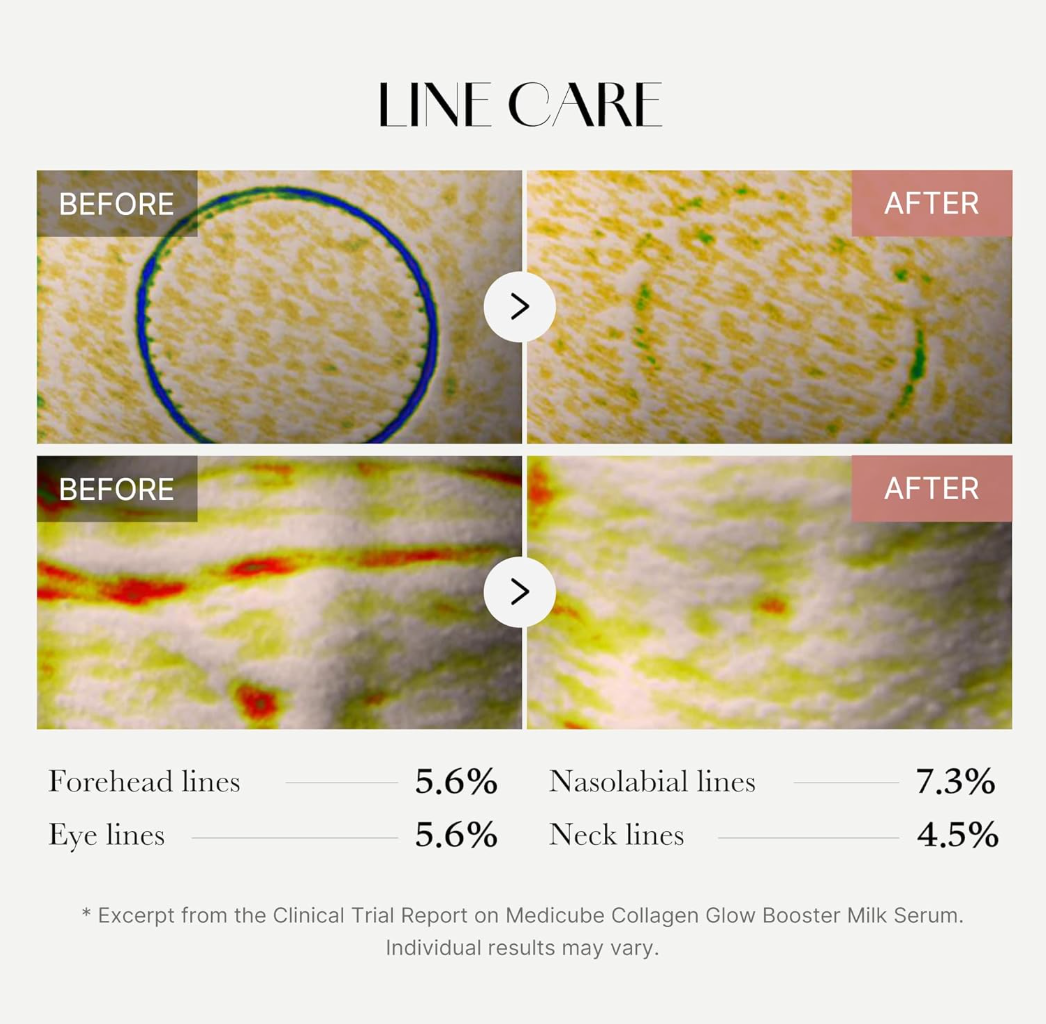 Before and after line care treatment on skin with visible results, Medicube Collagen Glow Booster Serum 15ml