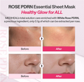 Advertisement for ROSE PDRN Essential Sheet Mask showing before and after effects on skin, Mediheal Rose PDRN Mask 10+1
