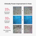 Before and after images showing clinical improvement in pores with percentages for blackhead, whitehead, and pore cleansing reduction, Biodance Collagen Cleansing Oil 200ml
