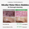 Advertisement for micellar water micro-bubbles with before and after skin condition images, MENOKIN Cotton Cloud Bubble Cleanser [Perfect] 150ml