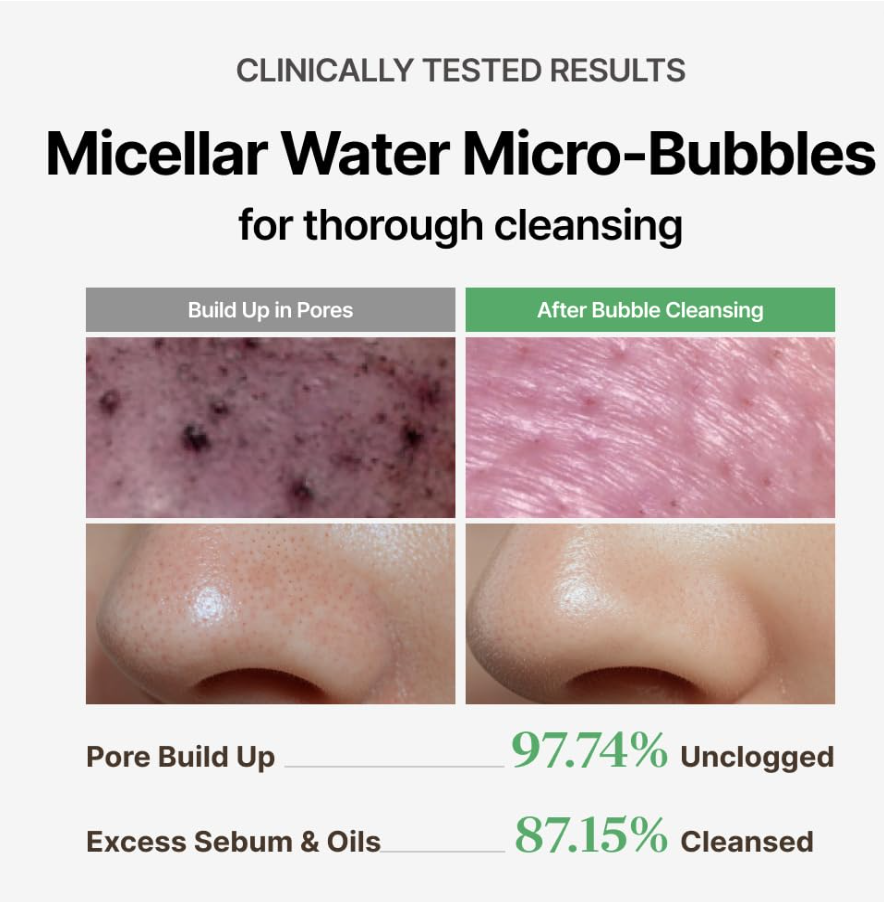Advertisement for micellar water micro-bubbles with before and after skin condition images, MENOKIN Cotton Cloud Bubble Cleanser [Perfect] 150ml