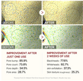 Before and after comparison of skin texture improvement with text showing percentage improvements, Dr.Melaxin PEEL SHOT EXFOLIATING WHITE RICE AMPOULE 80ml