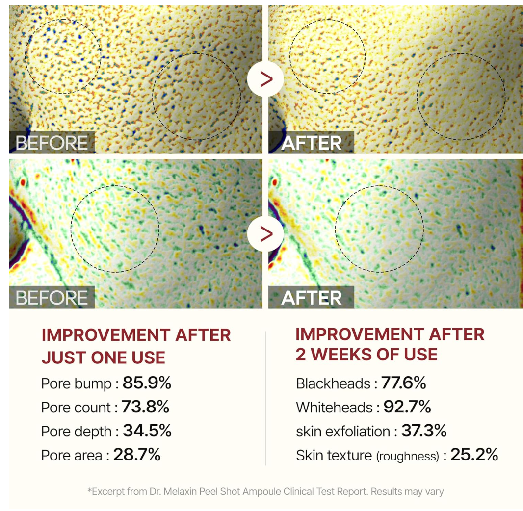 Before and after comparison of skin texture improvement with text showing percentage improvements, Dr.Melaxin PEEL SHOT EXFOLIATING WHITE RICE AMPOULE 80ml