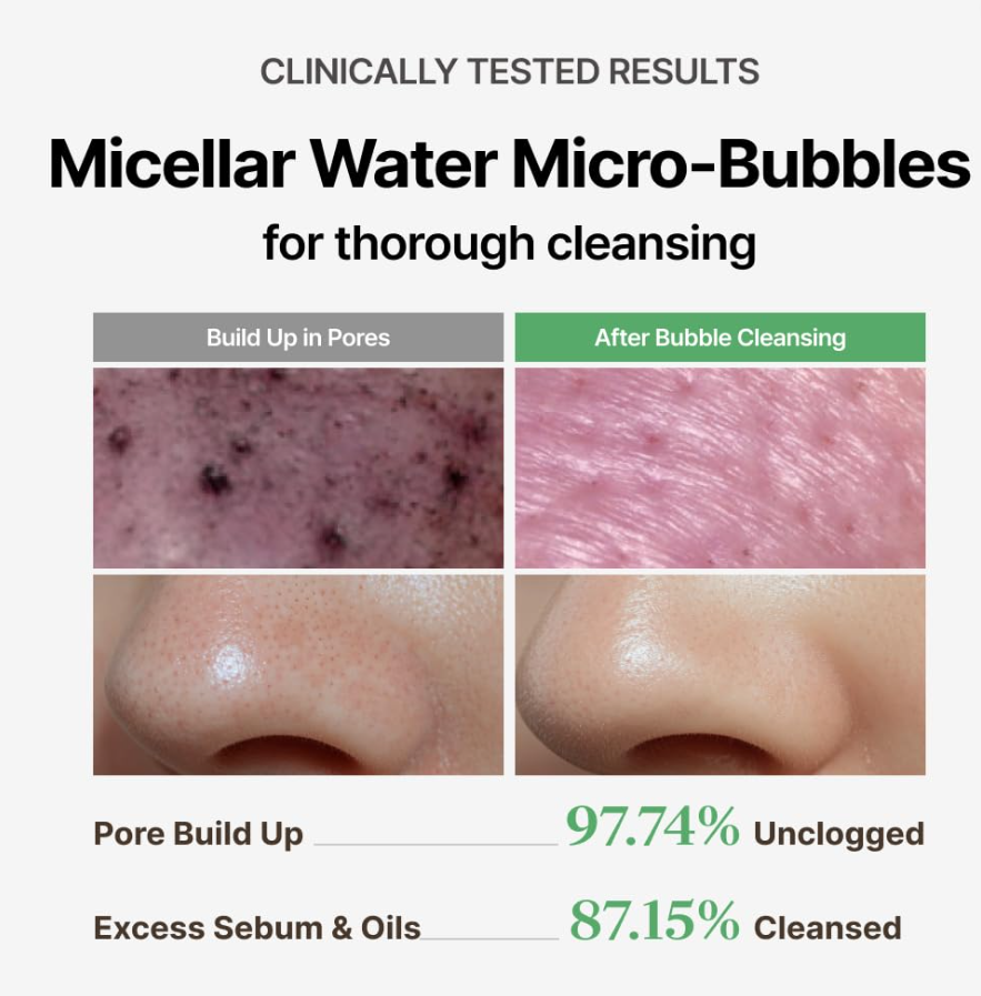 Advertisement for micellar water micro-bubbles with before and after skin condition images, MENOKIN Cotton Cloud Bubble Cleanser [Daily Comfort] 150ml