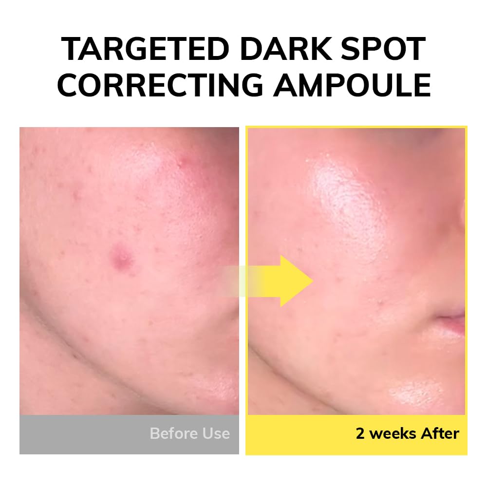 MIMUMIMU Niacinamide 10%+ Thioctic Acid Roll-on Ampoule-15ml